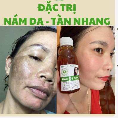 THẢO MỘC NÁM DA TRẦN KIM HUYỀN