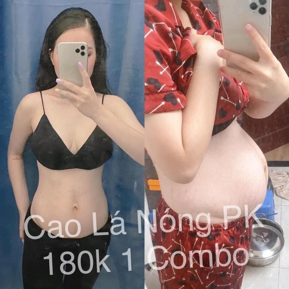 Cao lá nóng gia truyền ( giảm mỡ bắp tay- chân- đùi- bụng )