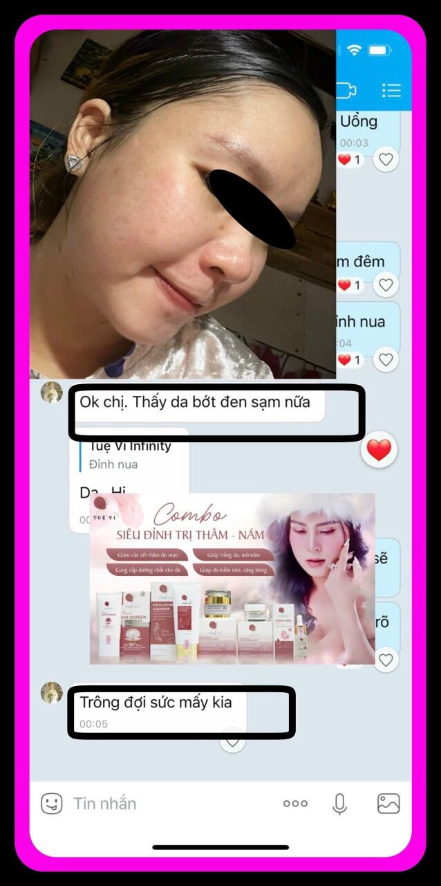 (Xịt bưởi Tuệ vi mẫu mới chính hãng cty)XỊT DƯỠNG TÓC X3 TUỆ VI,KÍCH MỌC TÓC NHANH,GIẢM RỤNG TÓC
