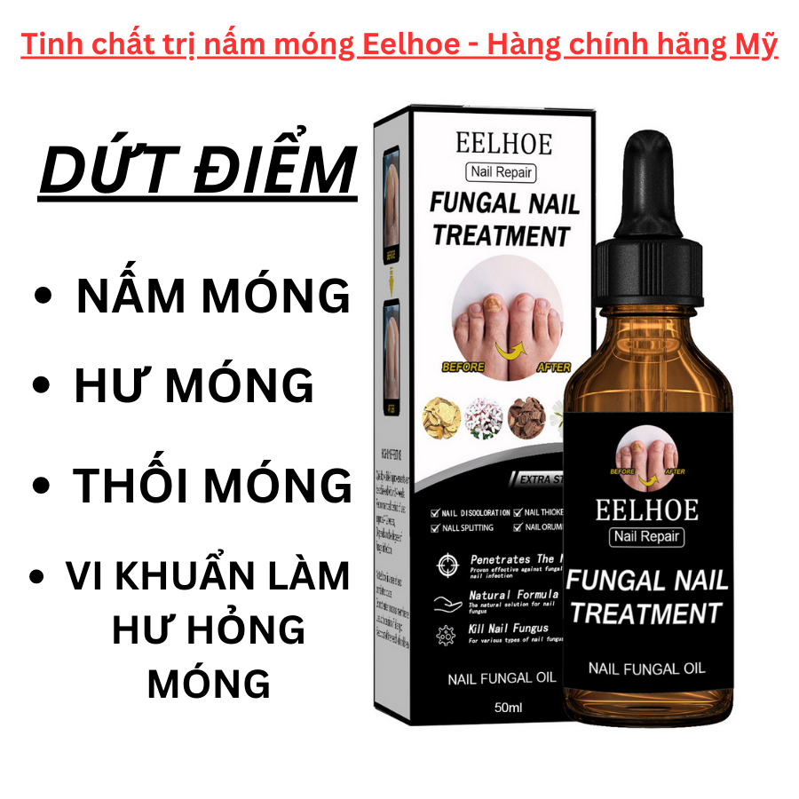 Tinh chất nấm móng tay chân Eelhoe, dưỡng móng chính hãng lọ 30ml