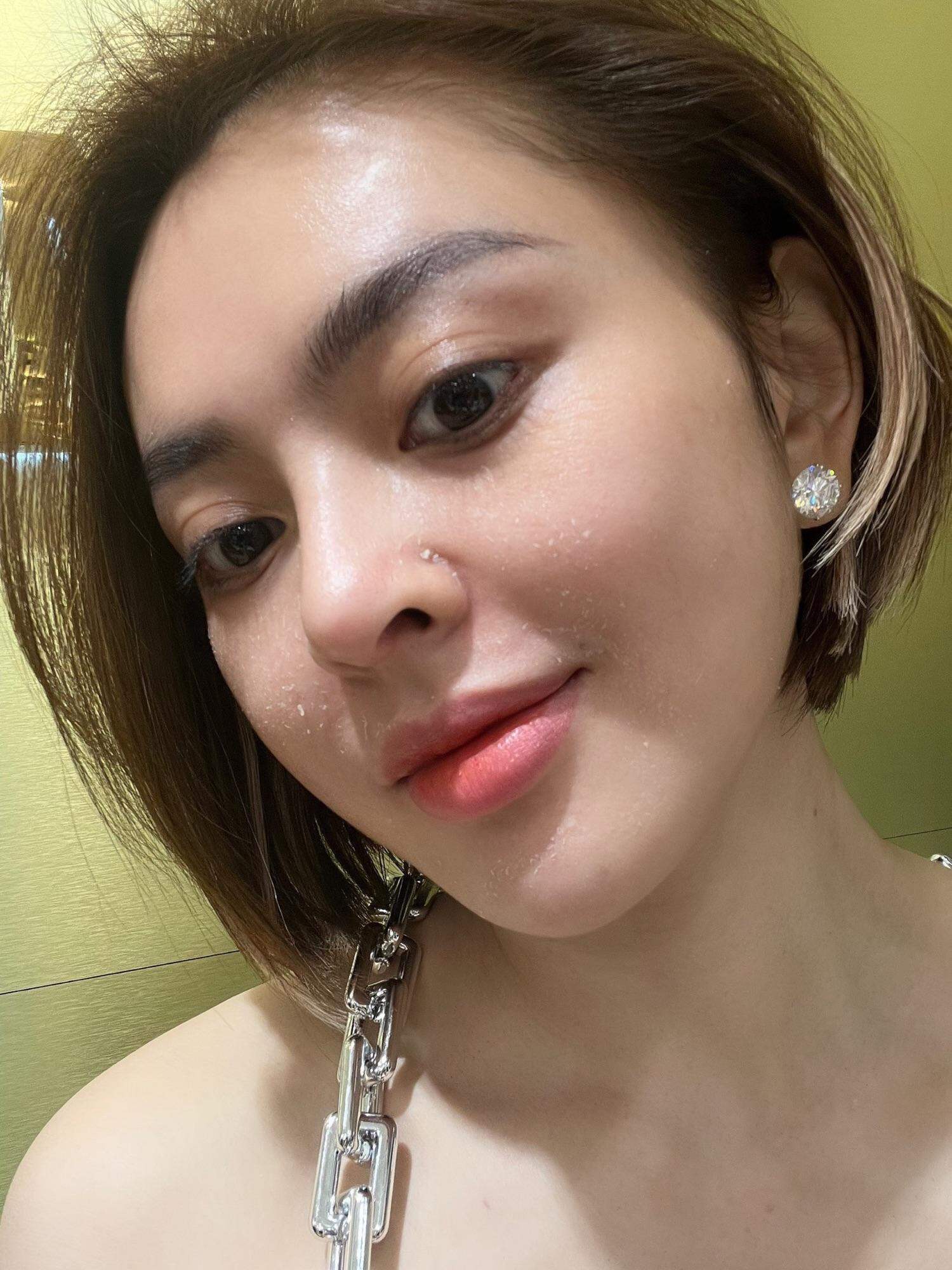 Peel da retinol vi tảo - trang nemo - peel số 1 và peel số 2