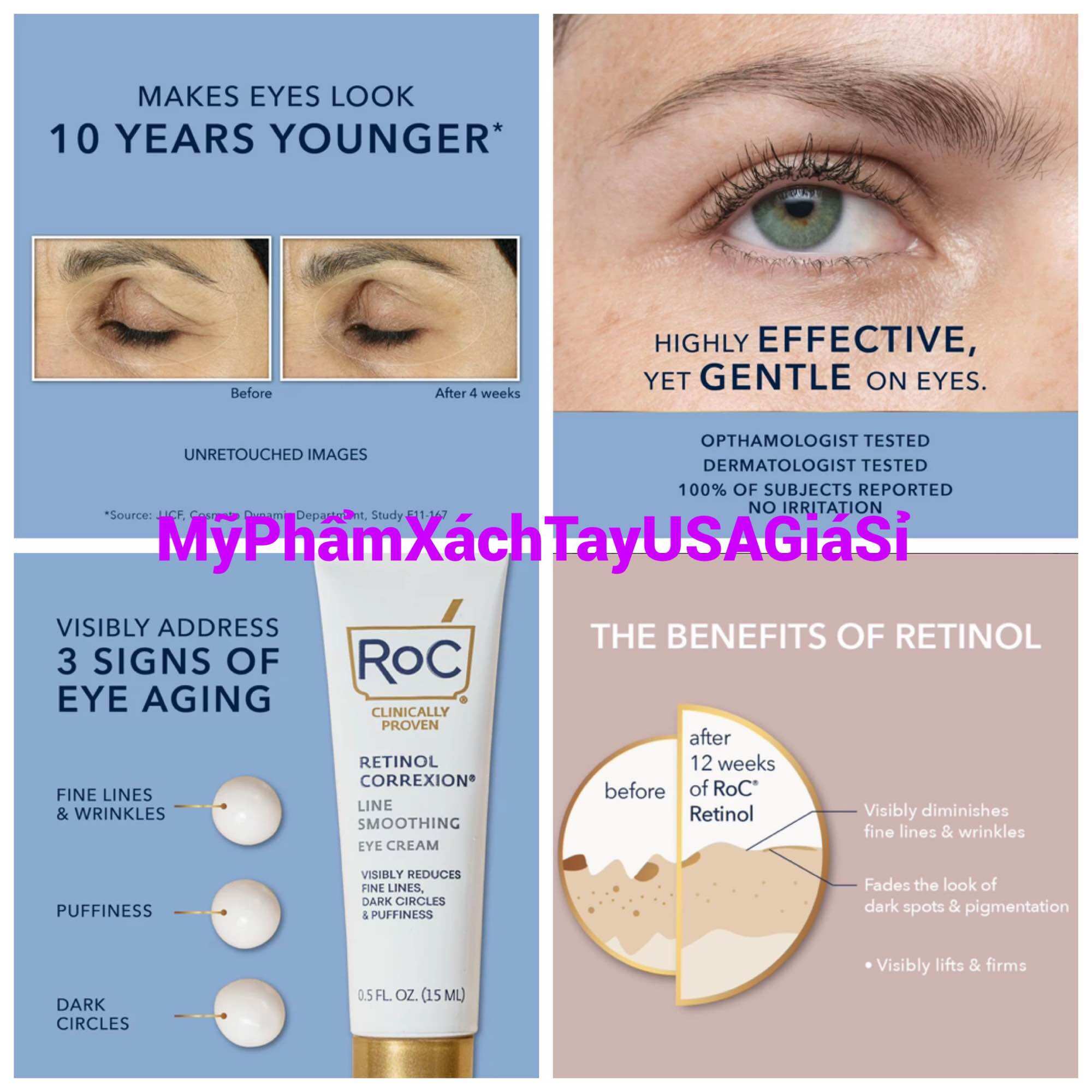 Kem mắt RoC Retinol Correxion Eye Cream 15ml