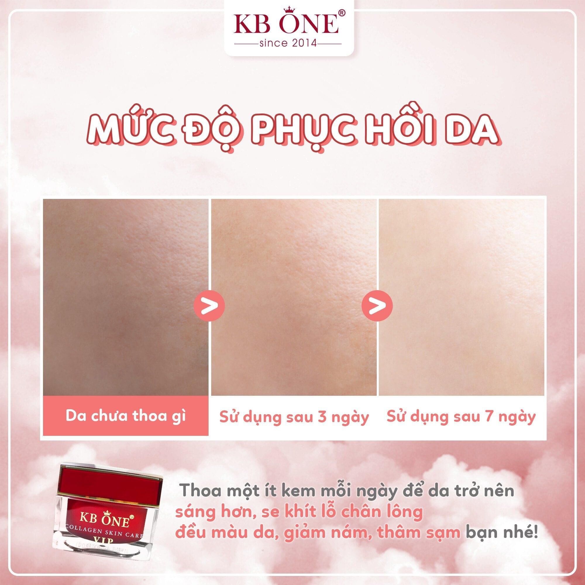 Kem KB.ONE VIP Đỏ 50gr Dưỡng Trắng Da Mặt Cao Cấp