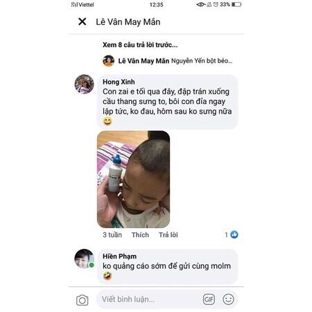 Xoa bóp thương hiệu Con đỉa