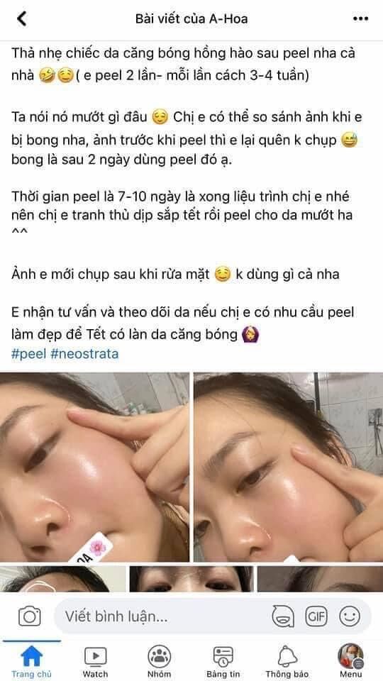 Tinh chất thay da sinh học NeoStrata ProSystem Retinol Peel