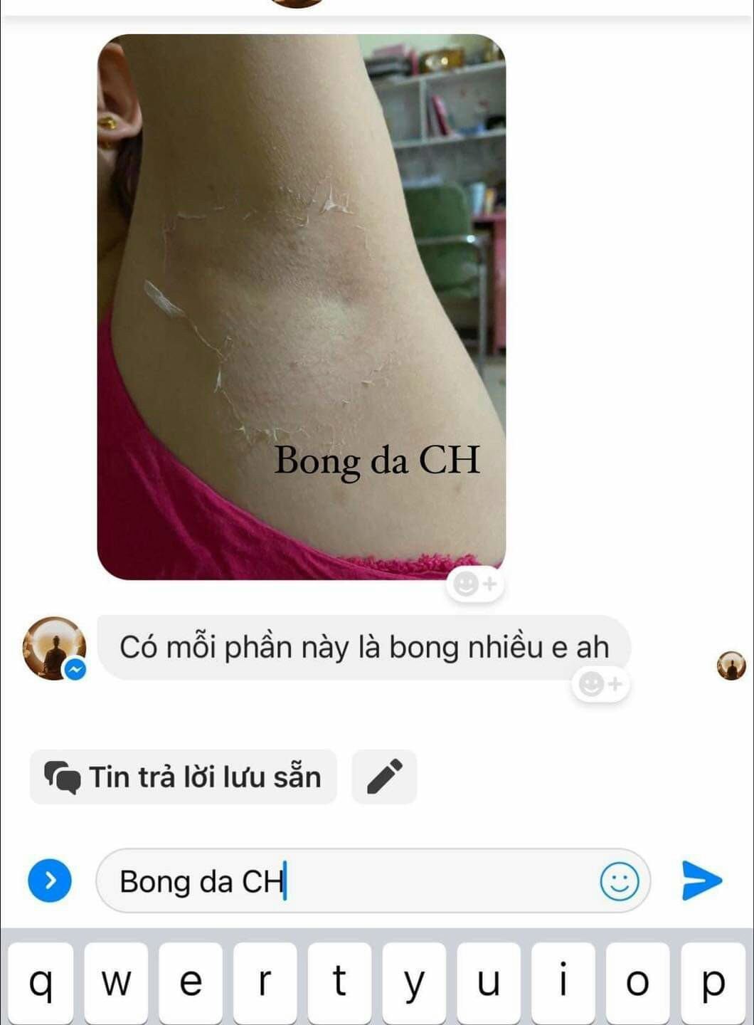 Body Bong Da CH Trắng Cấp Tốc Sau 7 Ngày