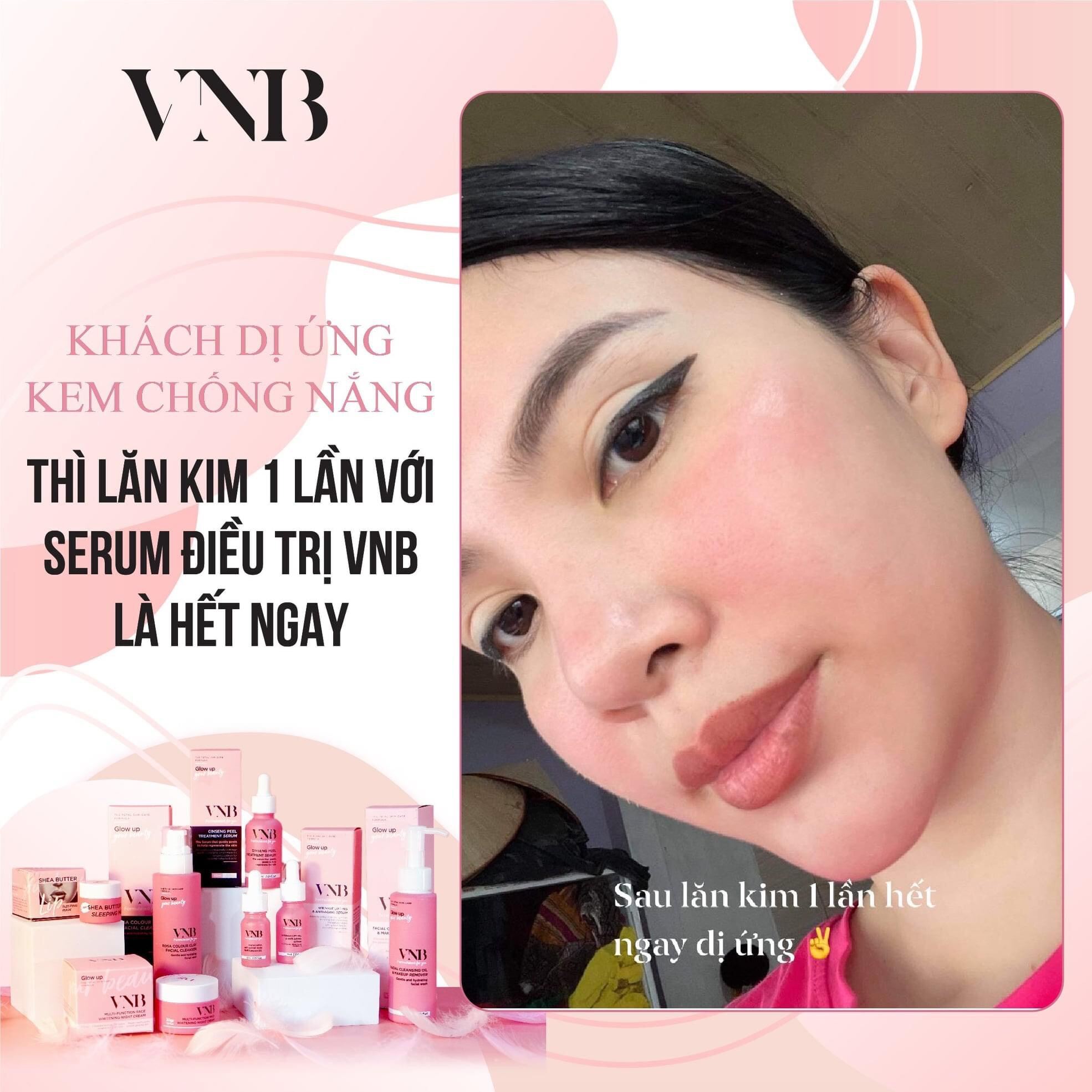 [Hcm]Serum Peel Vnb Phiên Bản Mới