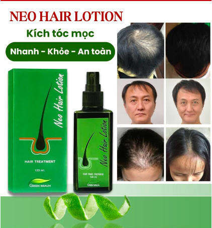 xịt mọc tóc của thái lan.