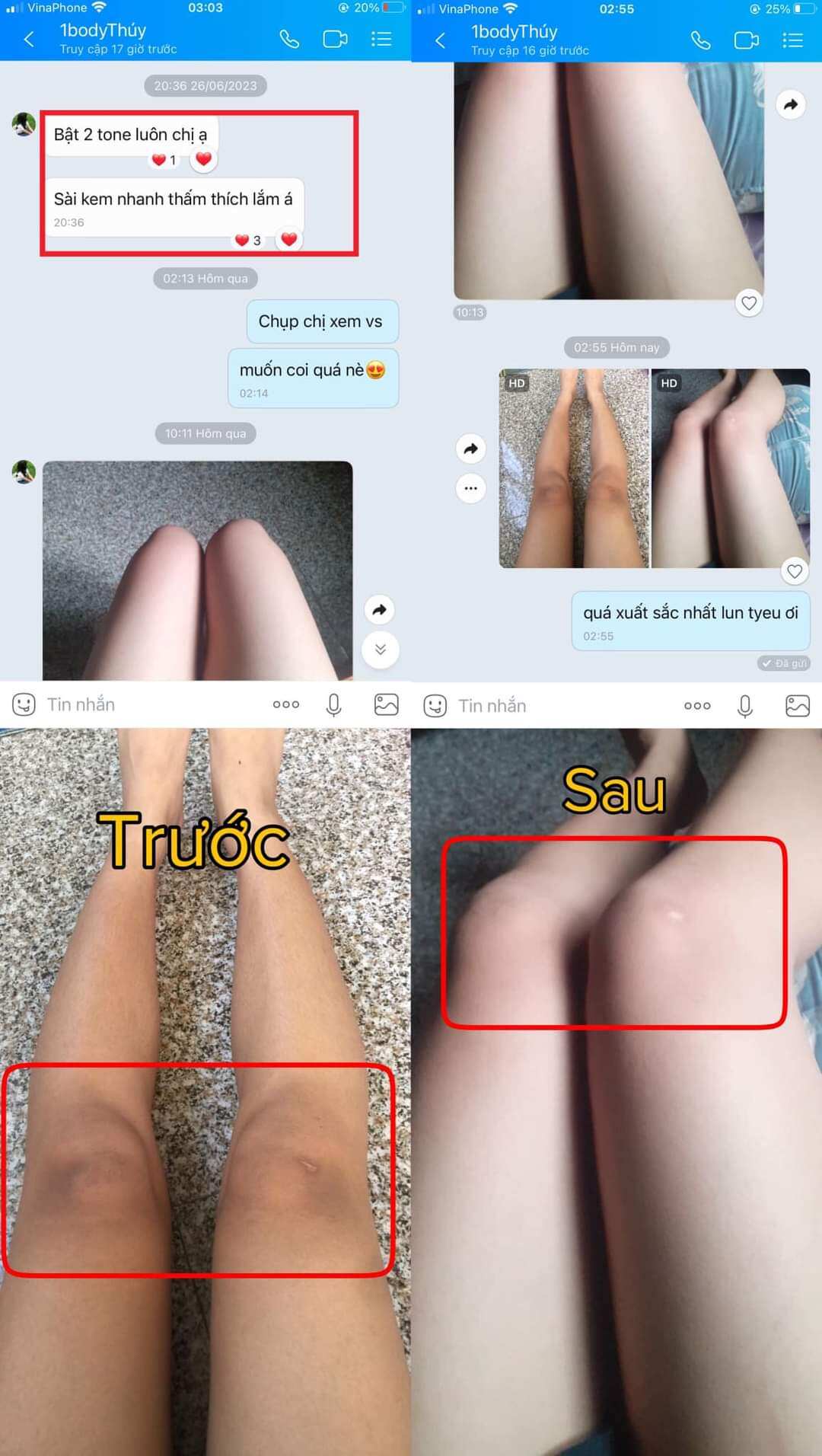 [mẫu mới]peel body,peel nách Le'peau