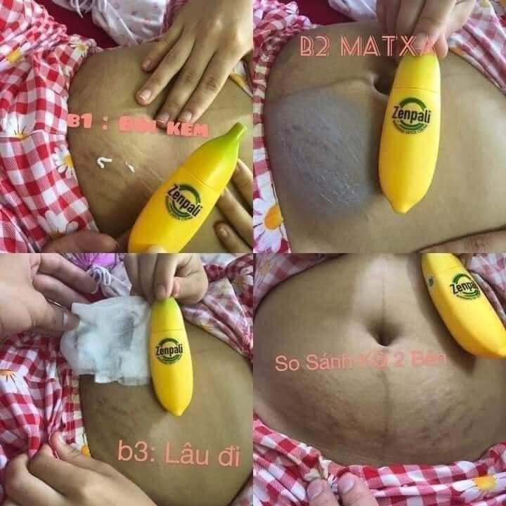 🍌🍌🍌Chuối Zenpali - Cấy trắng Detox Thải Chì Thải Độc🍌🍌🍌