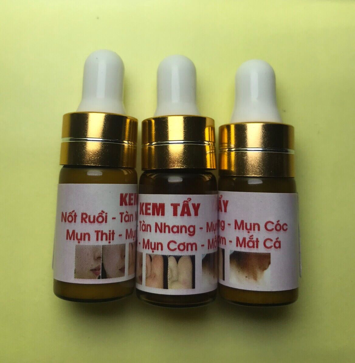 Tẩy nốt ruồi,mụn cóc, mụn thịt , mắt cá hiệu quả 100%