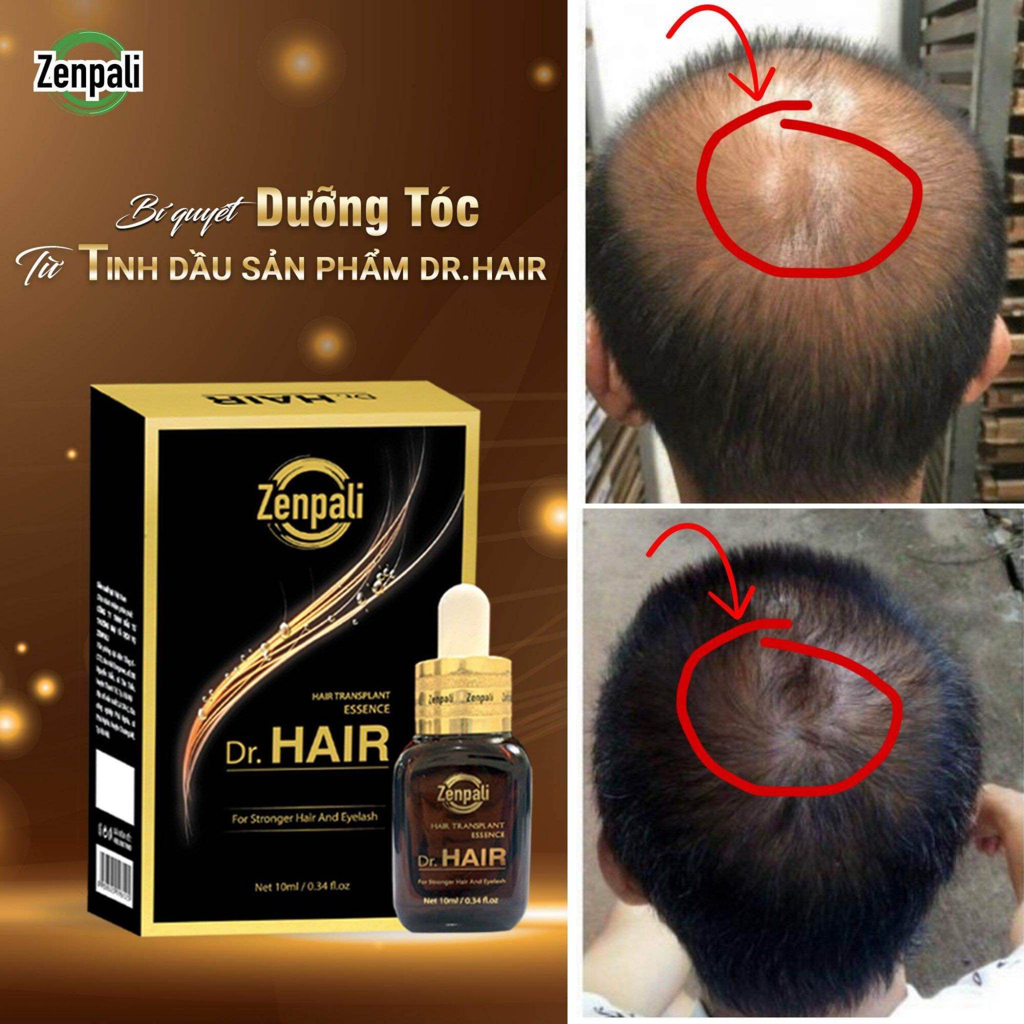 Dưỡng mi mọc tóc Dr.hair Mua 1 tặng 1 xóa tan nổi lo hói đầu