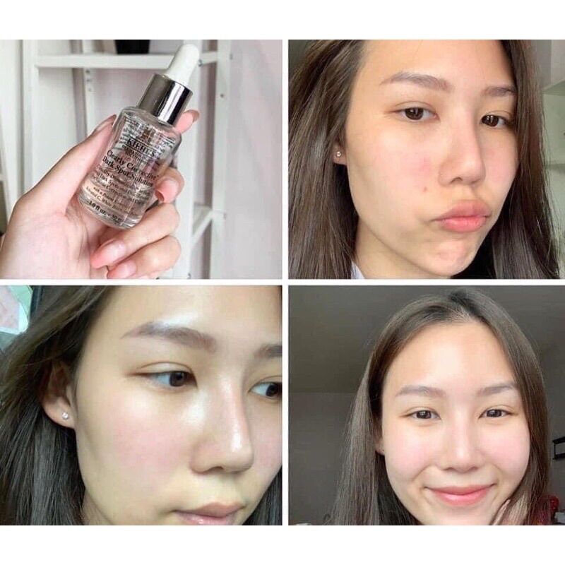 Sample 1,5ml Tinh Chất Serum Làm Sáng Da & Mờ Thâm Mụn kiehl's Clearly Corrective™ Dark Spot Solution