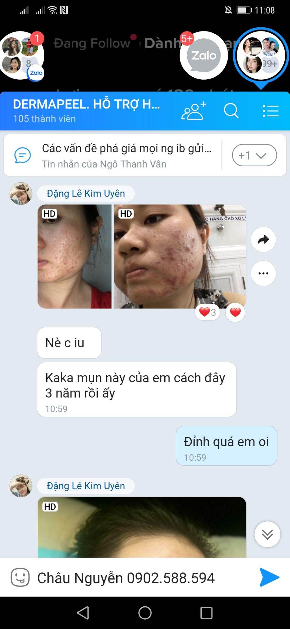 [HCM] Gel rửa mặt thải độc Dermapeel