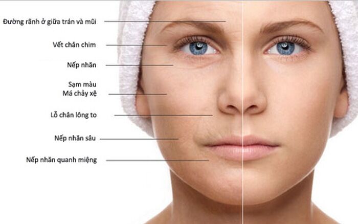 Viên uống Collagen 6 in 1 Spring Leaf Úc 90 viên