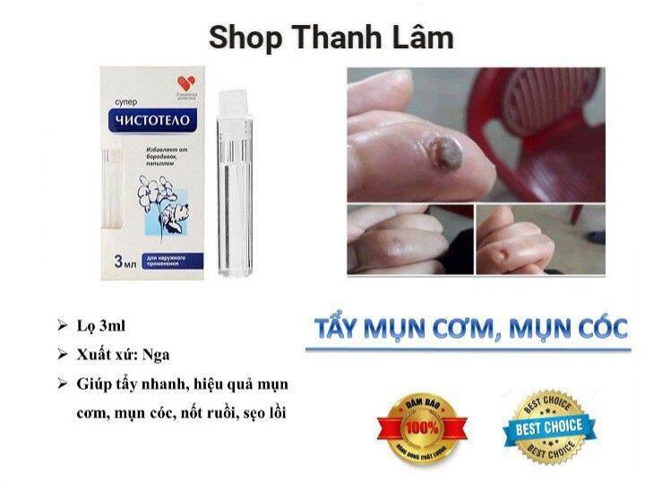 Gel Dvelinil Diệt Mụn Cơm Mụn Cóc Thịt Thừa Nốt Ruồi (Hiệu Quả Sau 3 - 5 Ngày)