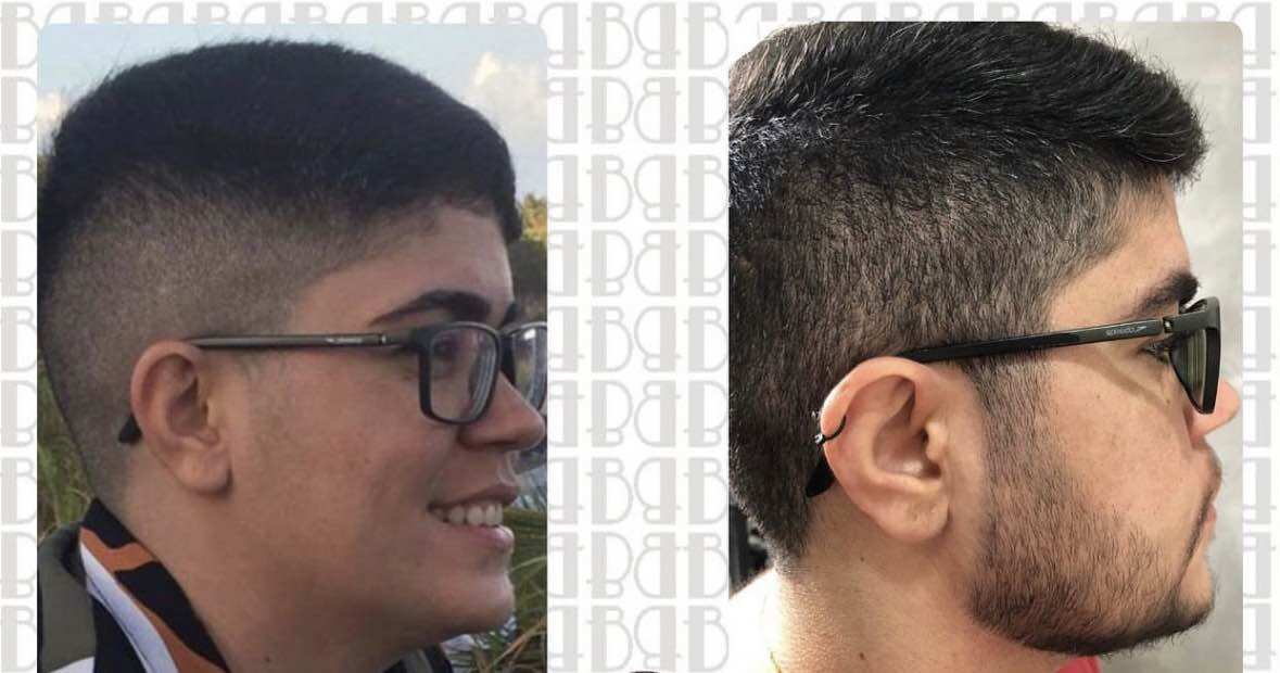 (Tặng 3 Ống LCLT) Hộp 6 lọ Minoxidil 5% dạng lỏng mọc râu tóc, chân mày