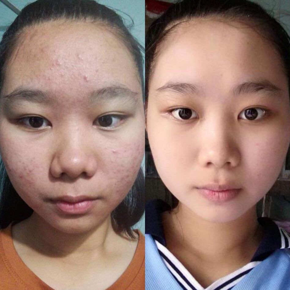 Tái Tạo Thanh Trang( Loại Cấp Tốc)