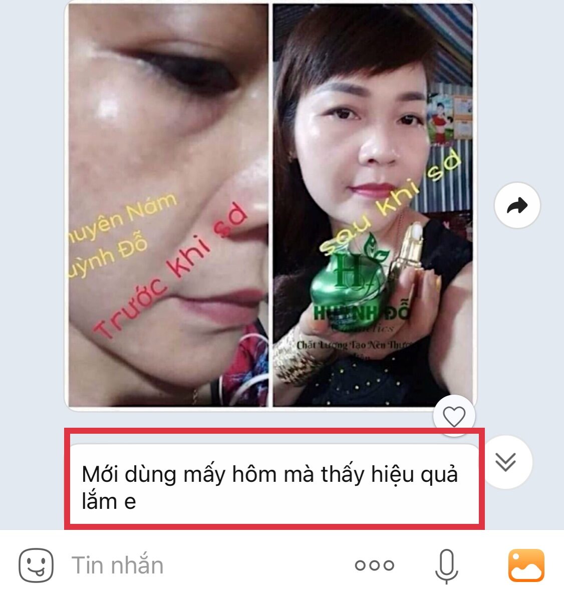 kem chuyên nám huỳnh đỗ