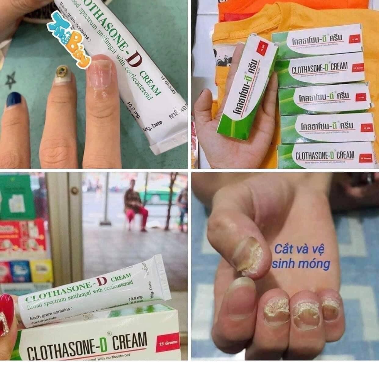 Kem bôi nấm móng Clothasone-D thái lan 15gr