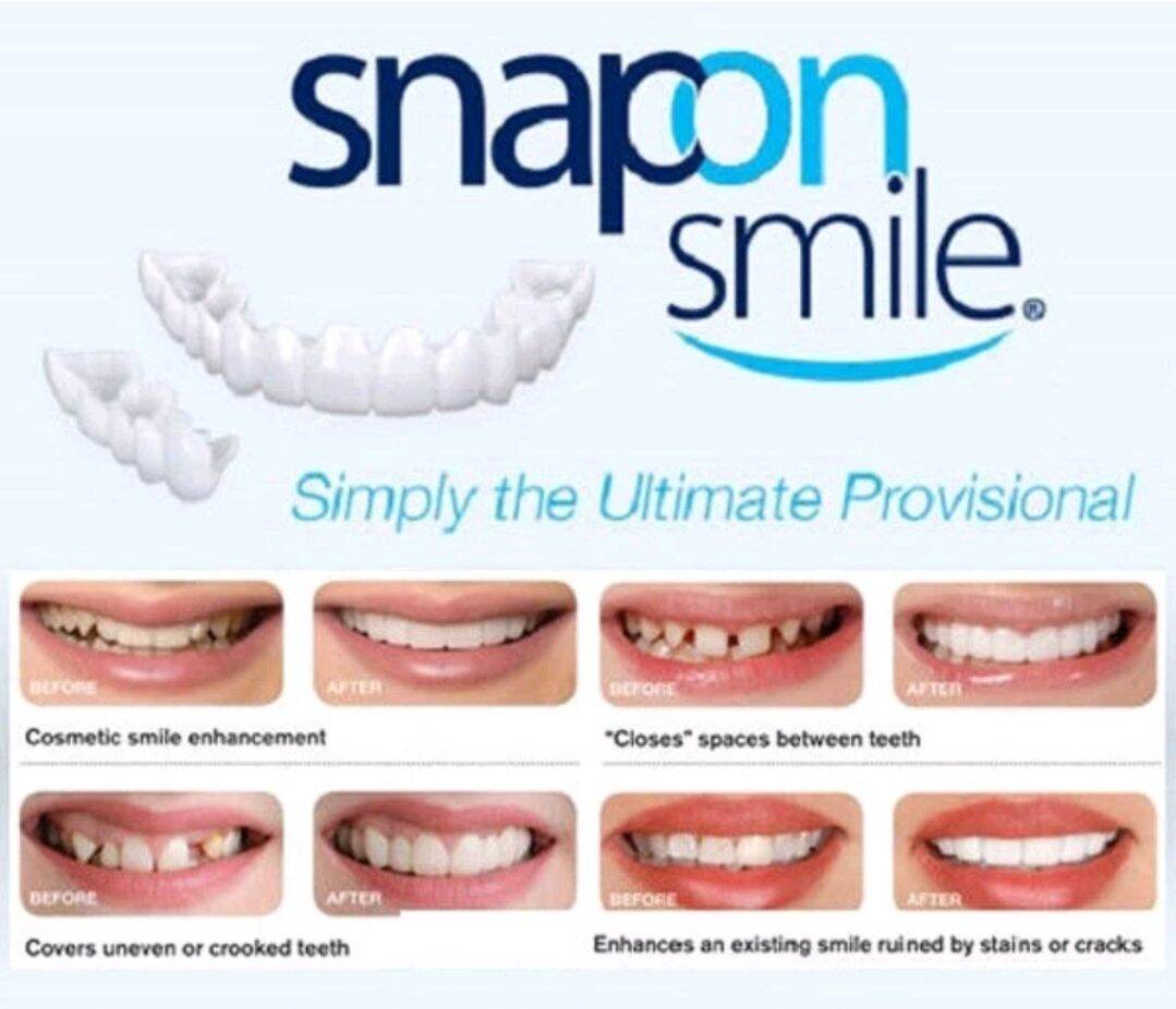 Răng giả Snap on smile cung cấp nhiều giải pháp để thay thế răng bị mất hoặc bị suy yếu. Snap-On Smile® mang lại sự thoải mái, tiện lợi và phù hợp với tính thẩm mỹ cao