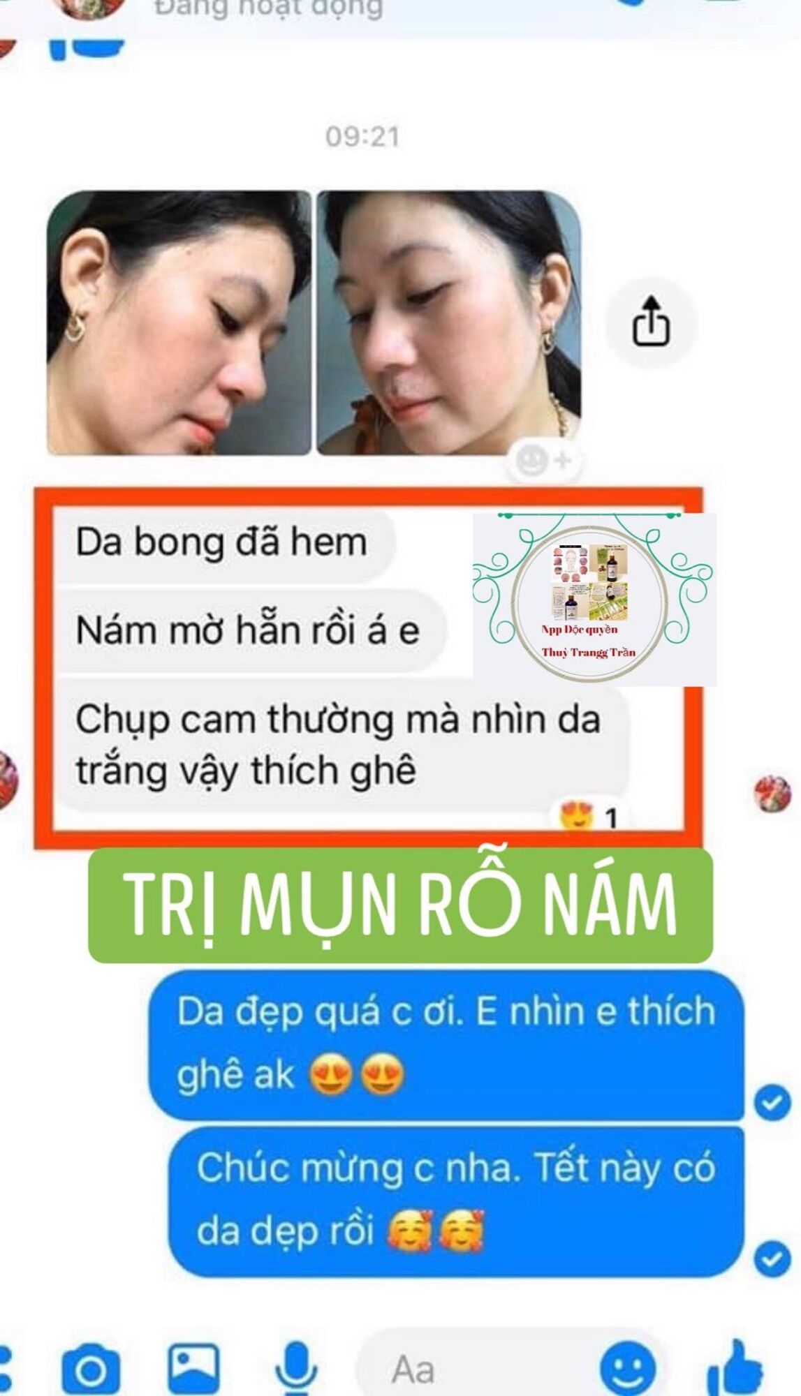 combo sạch mụn thâm rỗ 8 tuần(LO 100ML+ BOT KIEM DAU)