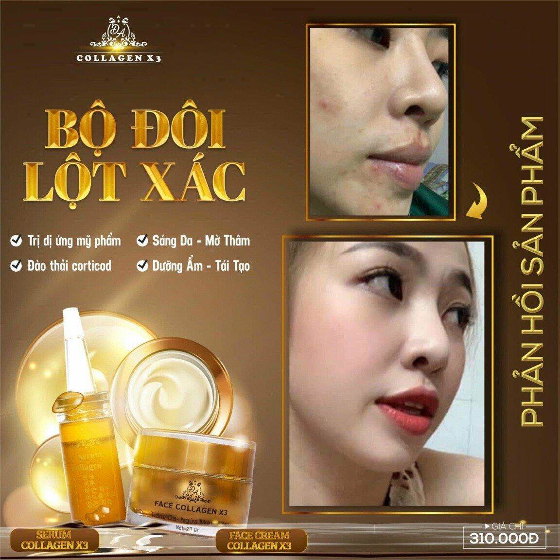 Combo Kem face X3 - Serum nám X3 collagen Đông anh Chính hãng