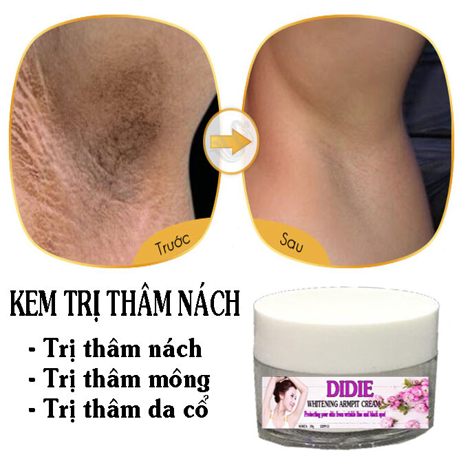 Kem Hết Thâm Nách DIDIE