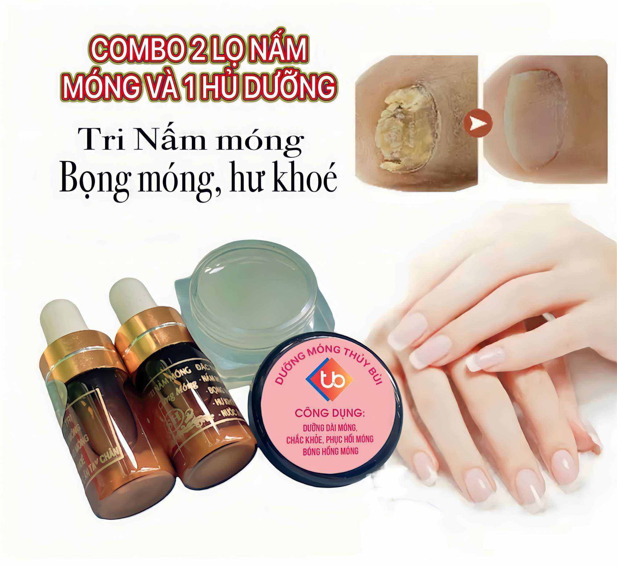 COMBO 2 Chai Nấm Móng và 1 Hủ Dưỡng Móng