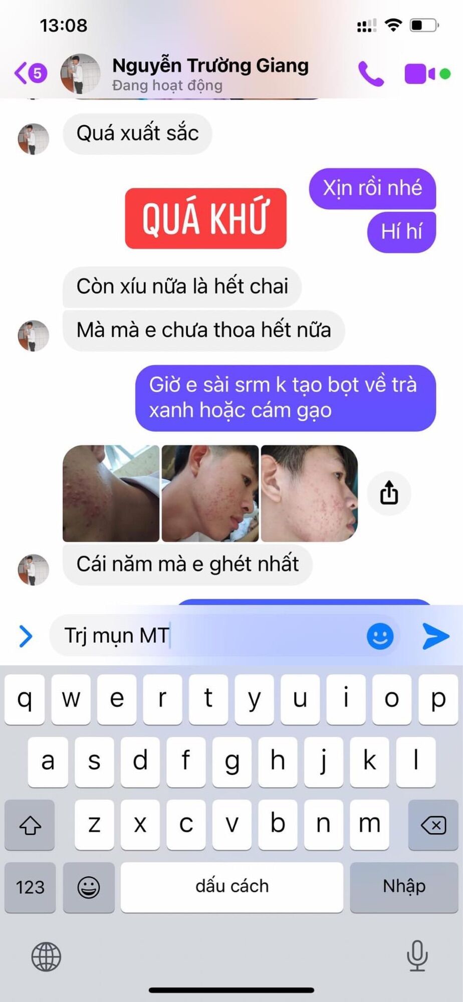 compo sạch mụn thâm nám hiệu quả  (50ml +bot rua mat)