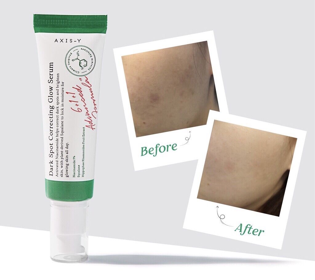 Axis-Y Tinh chất Dark Spot Correcting Glow Serum 50ml