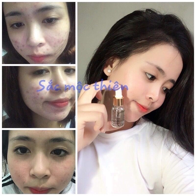 Combo 2 Chai Tinh Chất Dưỡng Da Sắc Mộc Thiên 10ml