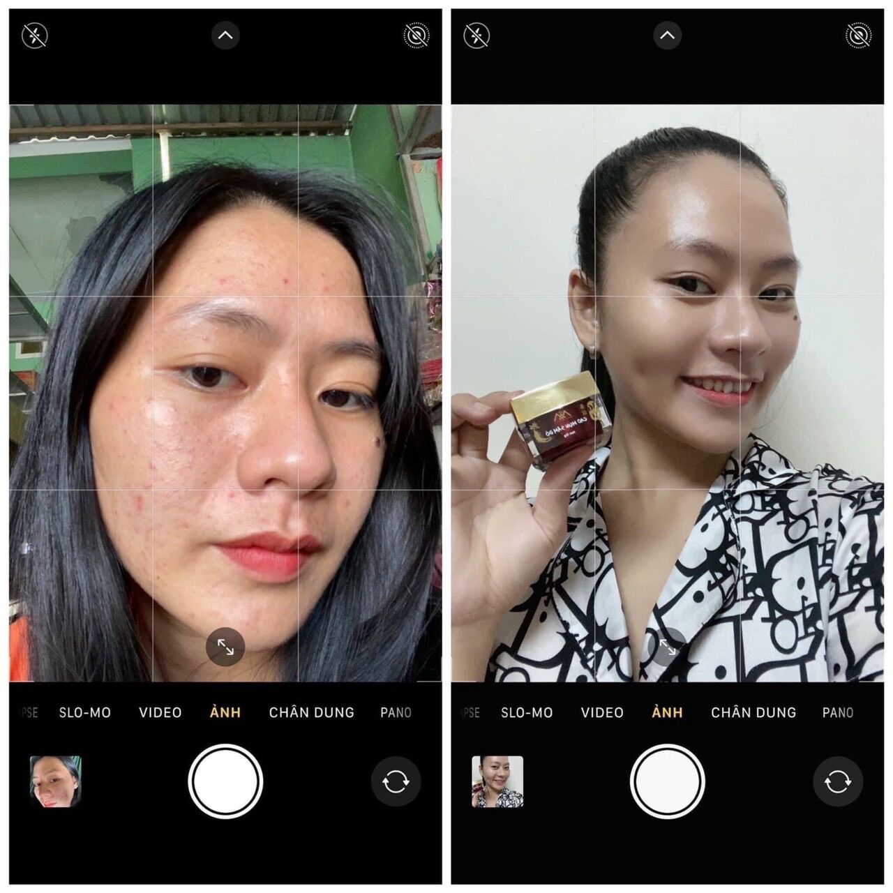 Hủ to Cao mụn sâm đỏ 36 vị 15gr