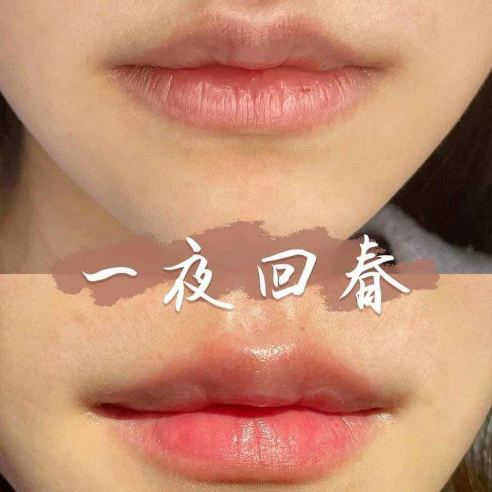[ mẫu mới ] Son Dưỡng Môi Vaseline Lip Therapy Blush Cherry Chính Hãng