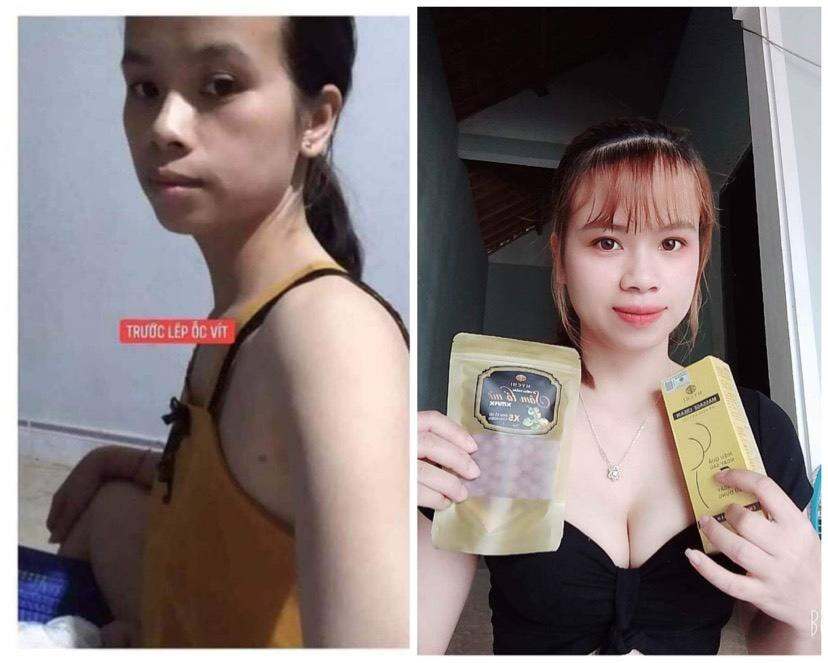 5 Hộp Kẹo Mầm Lúa Mạch Gold Thảo Mộc 37 Tặng Size Vòng 1 Đẹp Da Tăng nội tiết tố nữ