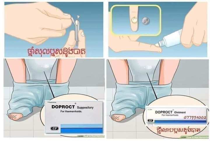 Kem bôi và đặt trĩ doproct thái lan