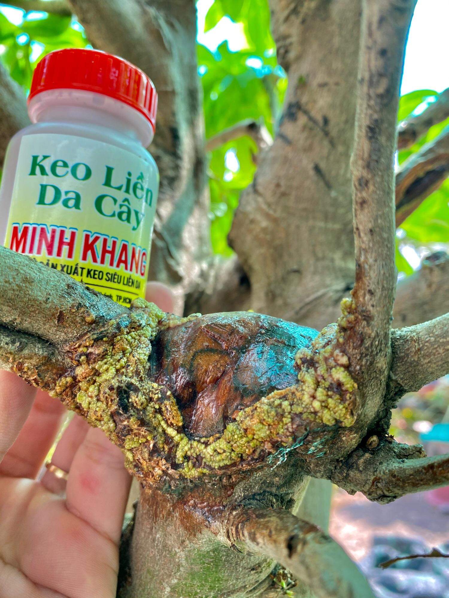 Keo Liền Da Minh Khang Chính Hãng