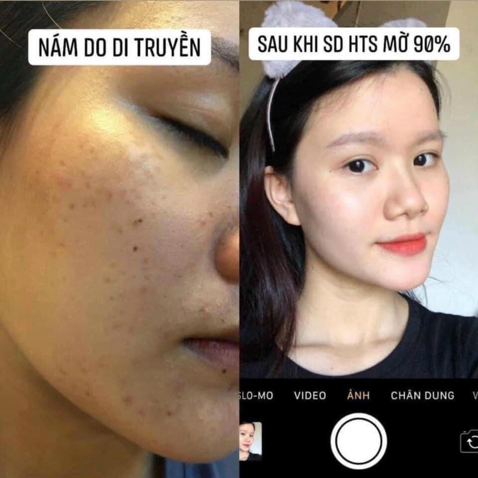 [FREESHIP] Combo Hoàng Thiên Sâm Siêu Tiết Kiệm Loại Vip (2 Tái Tạo Vip + 1 Bột Thảo Dược Rửa Mặt)