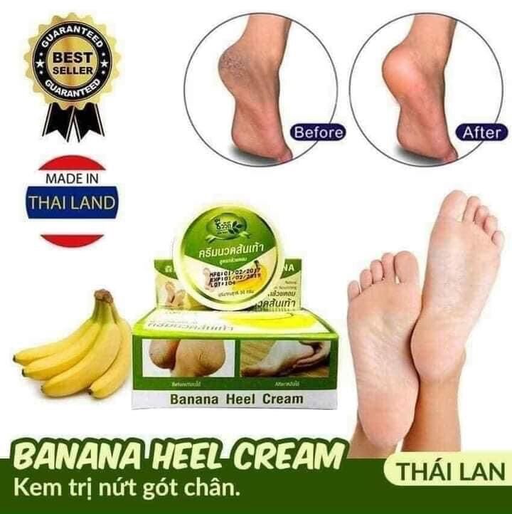 [HCM]Kem chuối Thái chống nứt gót chân