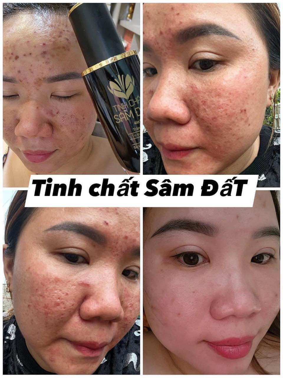Tinh Chất Sâm Đất DR CELL 50ml