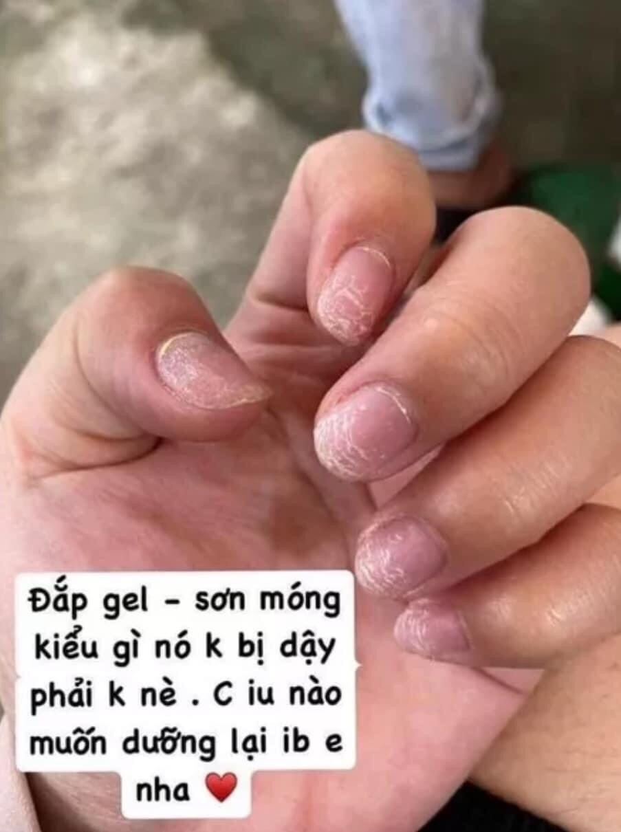 Dưỡng Móng Nhanh Dài Chắc Khỏe Sau Làm Nail