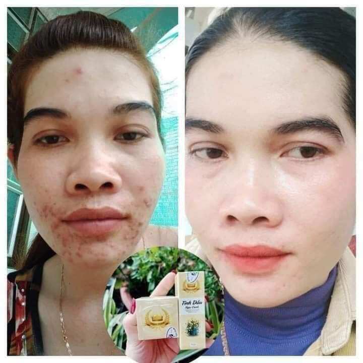 Kem Face Ngọc Oanh
