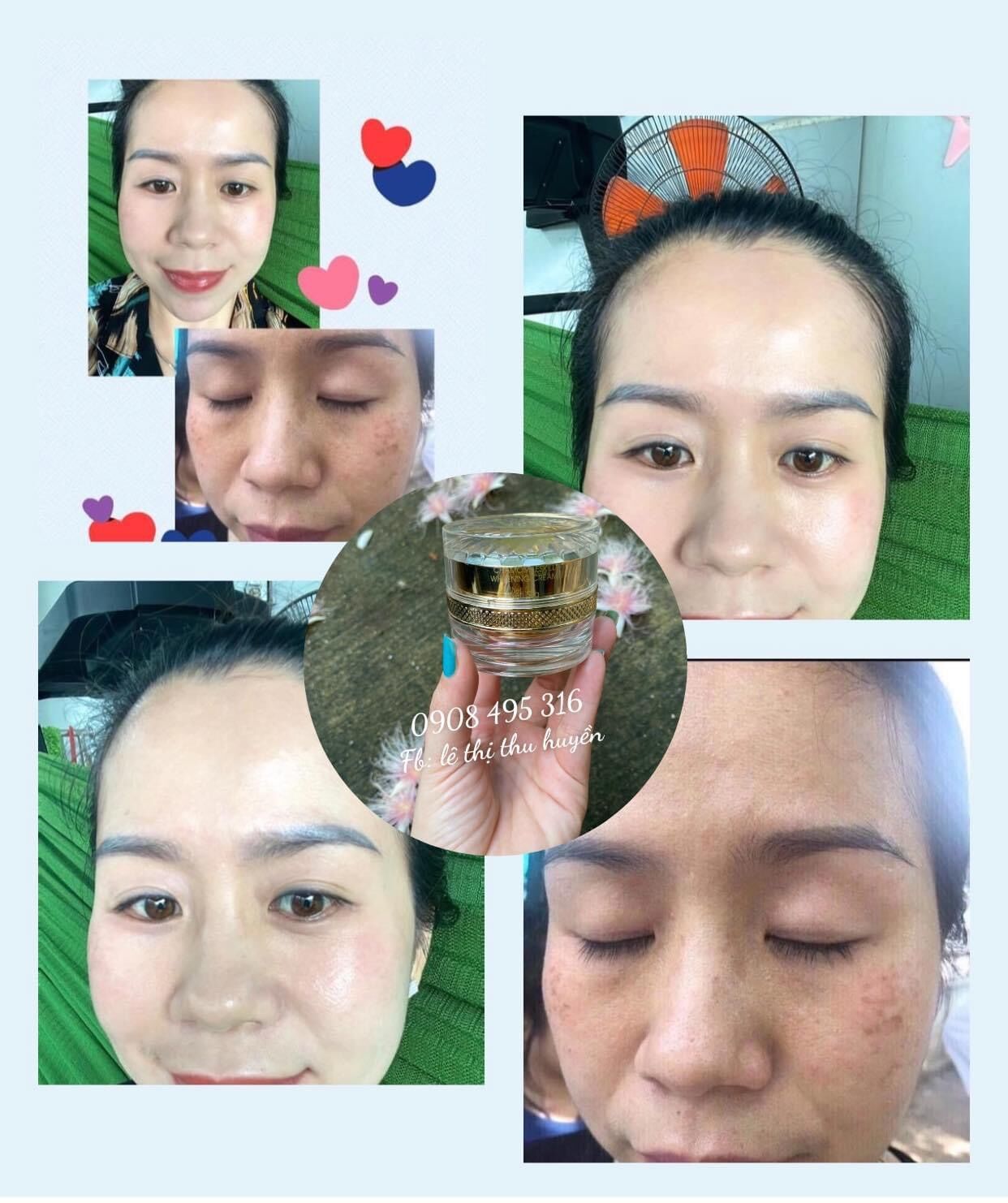 [HCM]KEM TÁI TẠO CHAMOMILESKILL