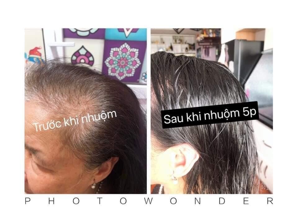 Dầu gội thảo dược phủ bạc tóc