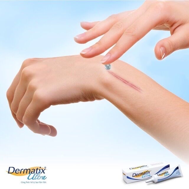 Kem Hỗ Trợ Mờ Sẹo Dermatix 15g