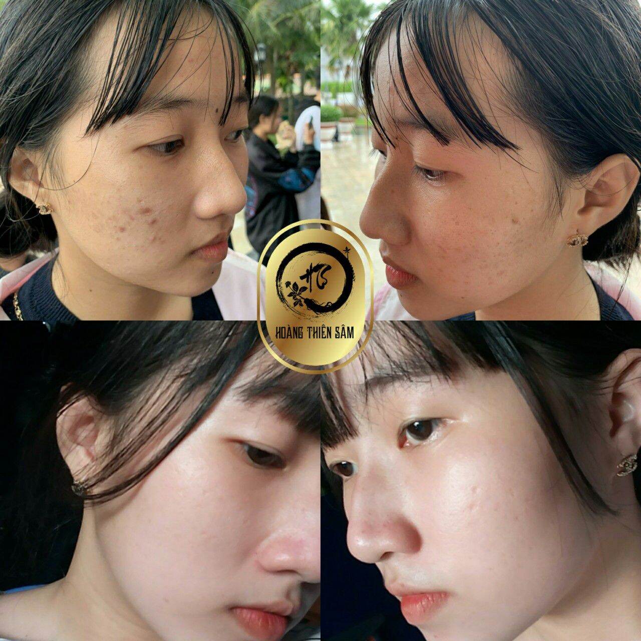 Combo Bột + Tái Tạo Da Hoàng Thiên Sâm 100gr + 30ml