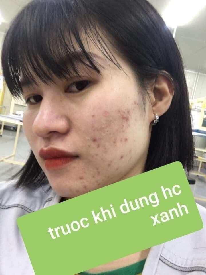 kem ngày hoàng cung xanh(lẻ)