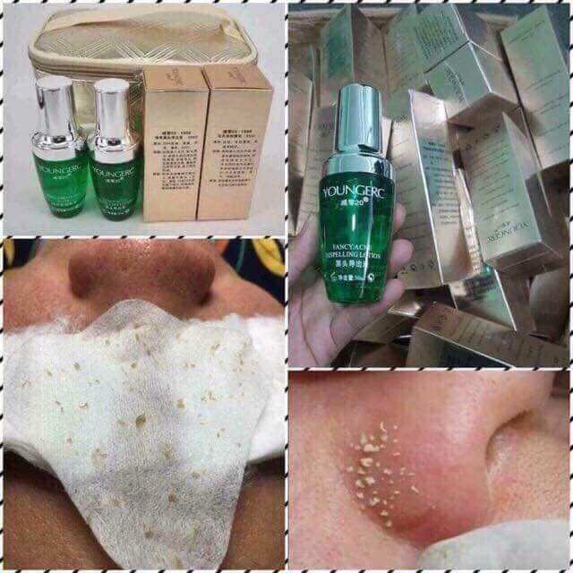 Ủ Mụn đầu đen, mụn cám Young Erc chai 30ml - SPA88