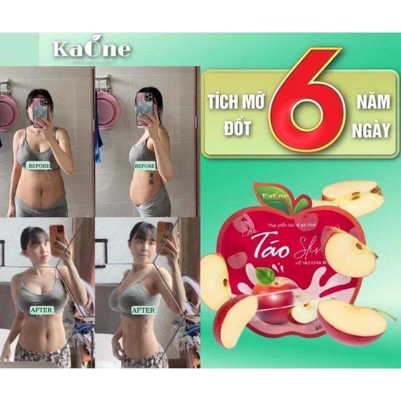 Kẹo táo Giảm Cân Kaone Slim + Kẹo Pro xổ mỡ vành ruột giảm mỡ bụng đùi bắp tay bắp chân