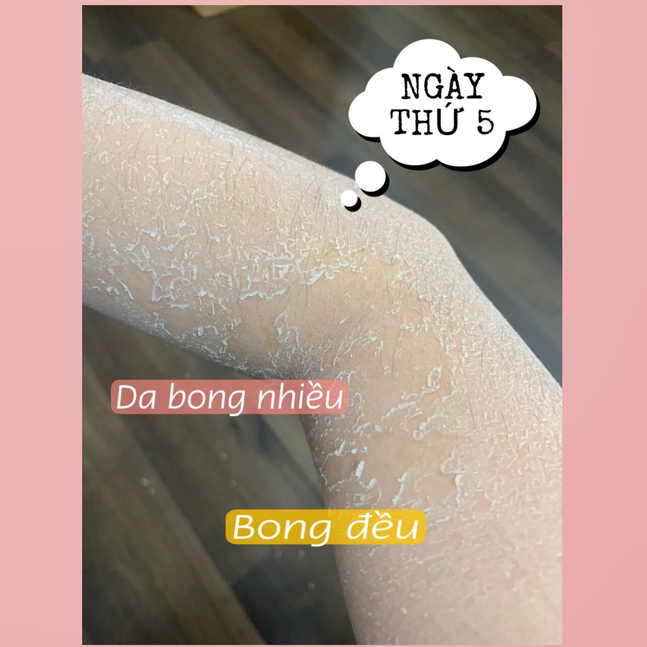 Combo Peel Da Body RETINOL ( Thay Da Sinh Học Hm store )